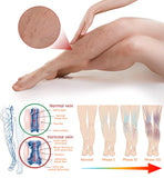 Turmeric Varicose Vein Patches (Buy 1 Get 1 Free)